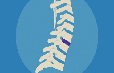 Cervicalgia